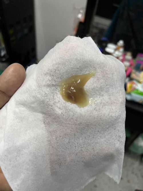 Lendir apa ya ini (weeks 39)