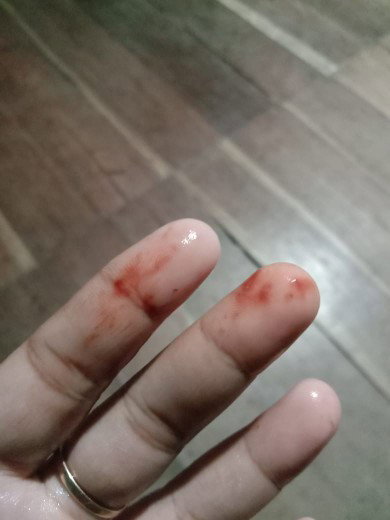 Awal kehamilan keluar darah