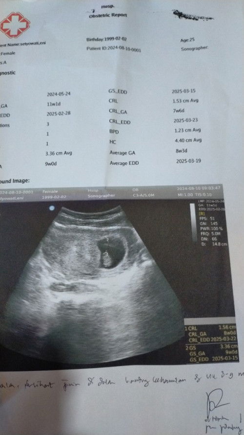 11week tapi USG 9week