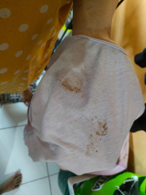 hamil 37wk keluar flek cokelat