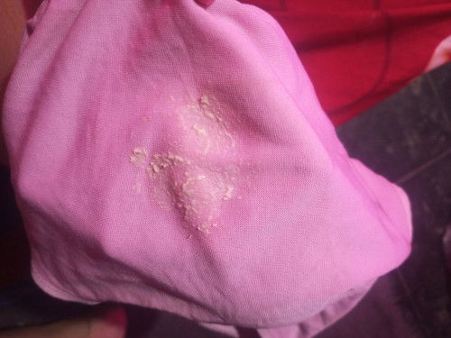 Keputihan saat hamil