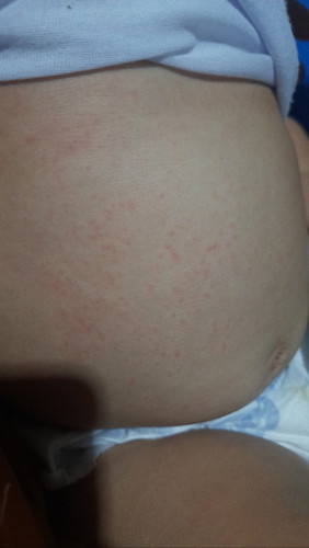 Ano po kaya tong lumabas sa baby ko 5 months po siya. Pinacheck up ko na po siya niresetan po