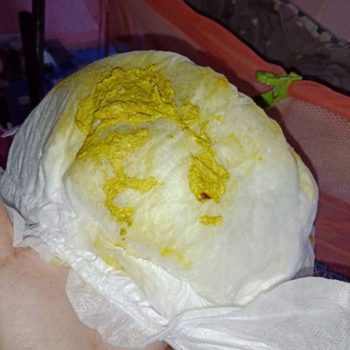 น้องจะเป็นอะไรไหมคะ