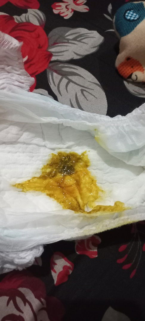 Warna dan tekstur bab bayi