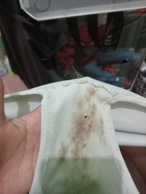 Ngeflekk di celana dalam