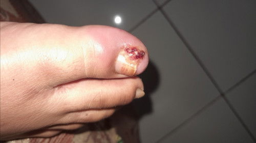 Temumulen/Centengan saat hamil