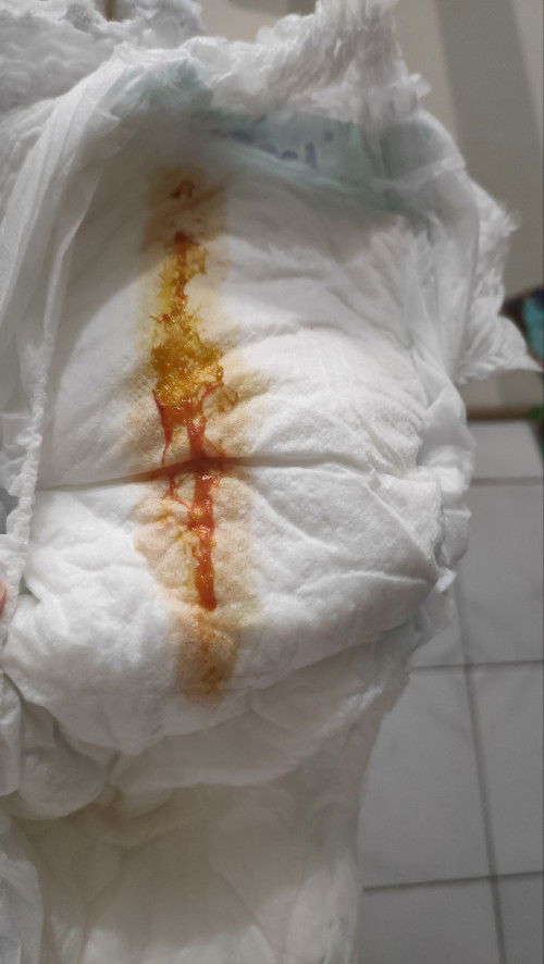 Pup bayi seperti berdarah(?)