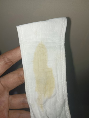 vaginal discharge