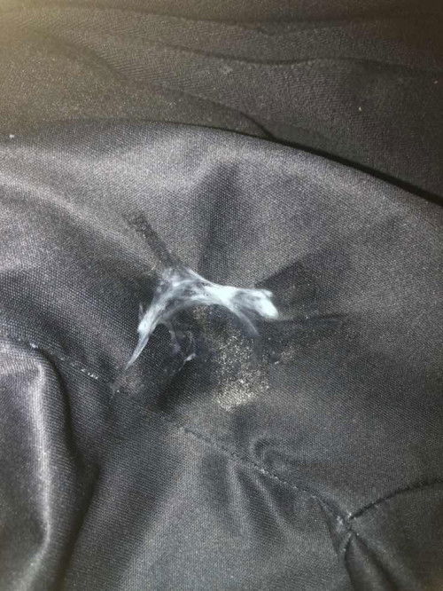 ควรไปรพไหมค้ะแบบนี้อายุครรภ์35+4ค้ะมีท้องแข็งแปปแล้วก็หายมีปวดหลังนิดหน่อยค้ะ