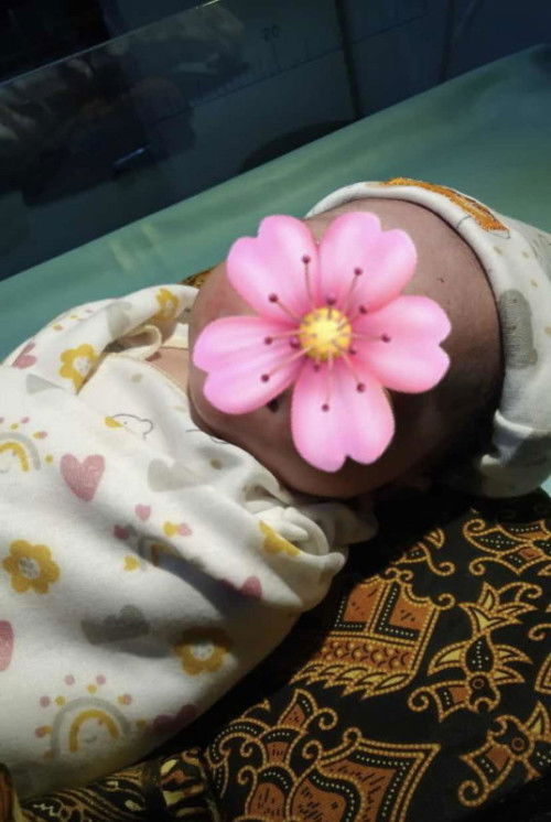 alhamdulillah hpl 15 agustus , lilitan 1x + ambiein