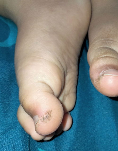 Kaki belah dan kasar kaya gini anak 1thn knp ya? Saran dong pakein apa biar g kasar sembuh