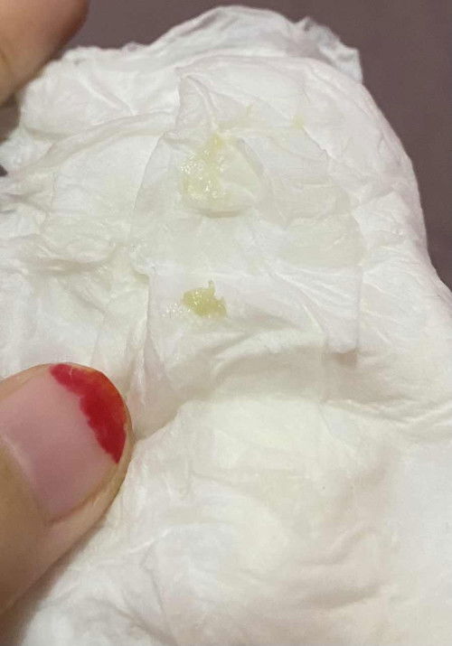 Keputihan saat hamil