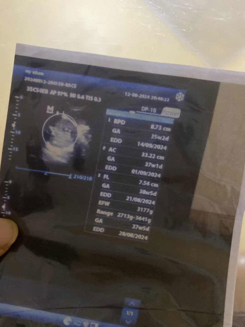 BPD tidak sesuai usia kehamilan (lebih kecil)