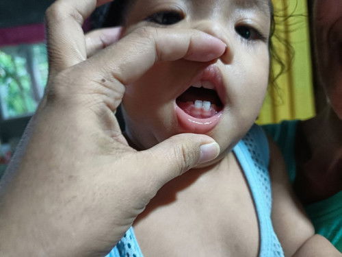 Breastfeeding struggles ngayung my teeth na si baby