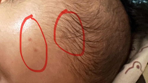 Muncul merah di area sekitar kepala