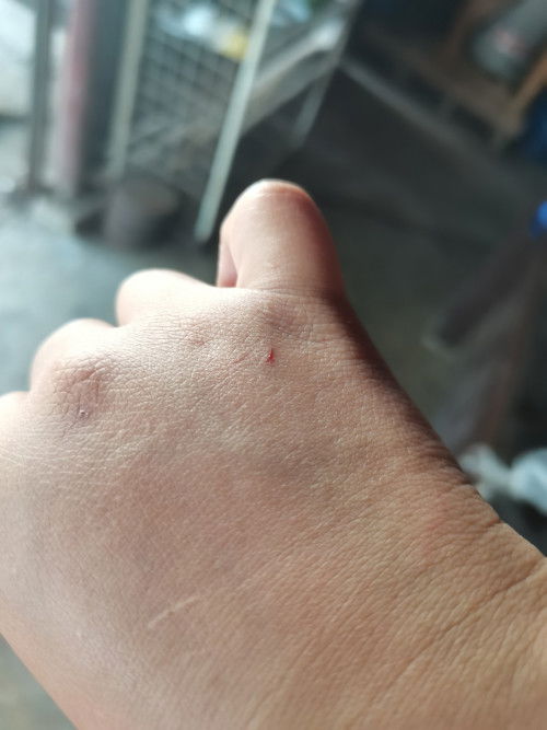 Anti rabies for 9mos preggy safe?