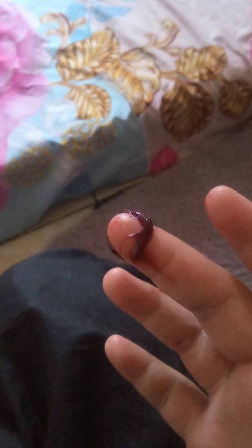 Keluar bercak darah di usia 37week 4hari