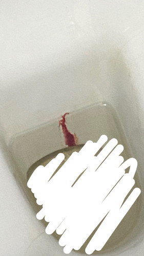 KETULAN MERAH MACAM JELLY