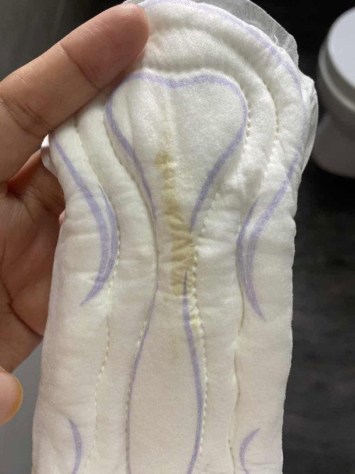 Normal ke discharge macamni?