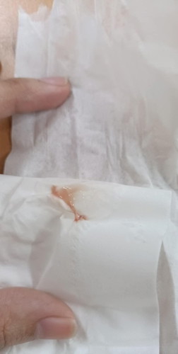 ท้อง18 สัปดาห์ มีมูกเลือด