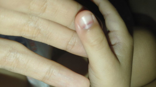 jari anak terkepit pintu grill