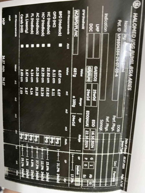 Hasil Usg Cewe/Cowo?