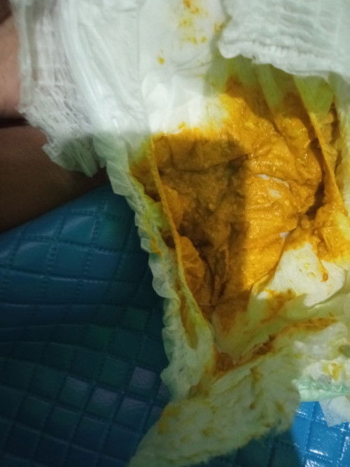 Maaf agk jorok poop gitu normal g yah maaf newmom suka khwatir