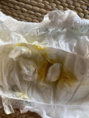 ลูกอึแบบนี้เหมือนมีเลือดปน ผิดปกติมั้ยค่ะ