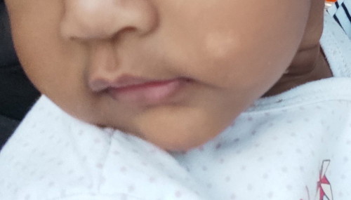 pipi baby ada tompok/ruam
