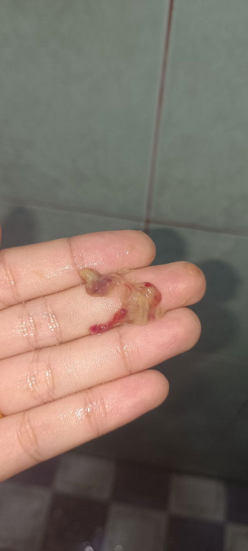 Apakah ini darah nifas juga?