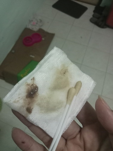 มีแบบนี้อยู่ในช่องคลอด