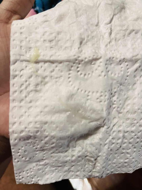 Mucis plug na ba ito?