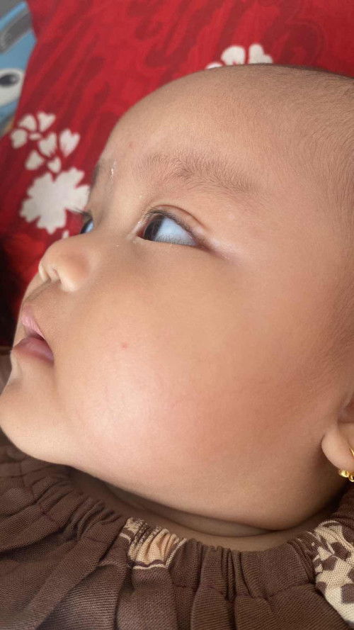 bercak putih sekitar kelopak mata