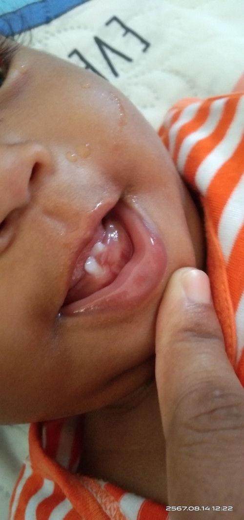 ฟันน้ำนมของเด็ก 9 เดือน