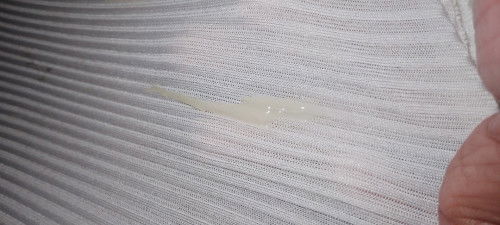 Normal po bang magka discharge ng ganito. 5 months preggy po