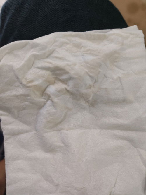 Flek . Ada yang tau ini kenapa . Dan harus gimana . Pengalaman 3x keguguran