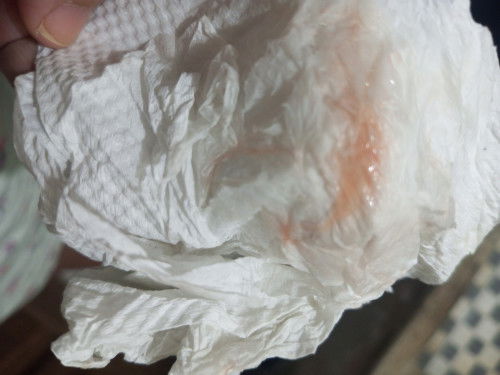 Haid 41 hari masa nifas