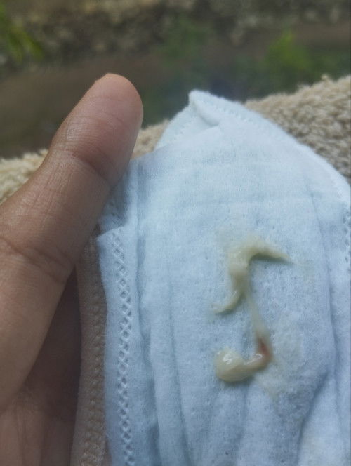 Keputihan ada darahnya