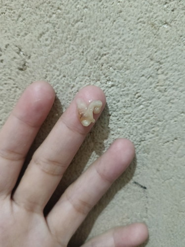 Ano kaya ito mga mommies? 31 weeks preggy.