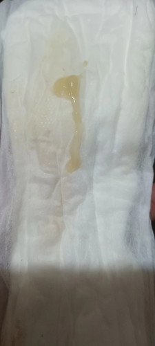 mucus plug b to?