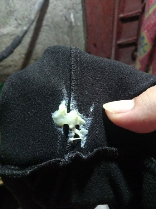 Hello po mga ka mommy matanong ko lang po kung normal lang po ba ito . 8months preggy po ako