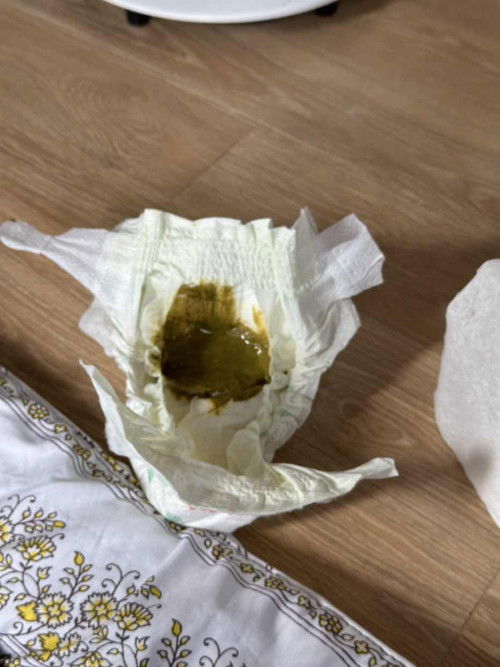 ลูกอึแบบนี้ปกติไหมคะ