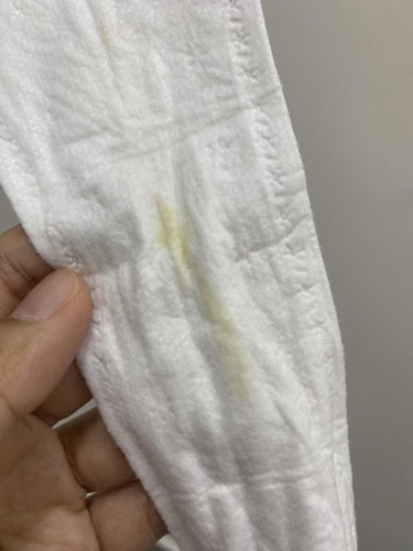 discharge yellowish