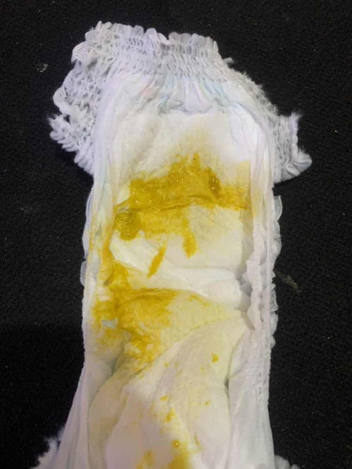 Feses anak berwarna kuning cerah