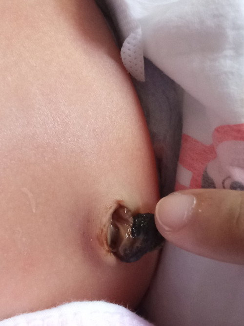 22 days di pa nahuhulog pusod