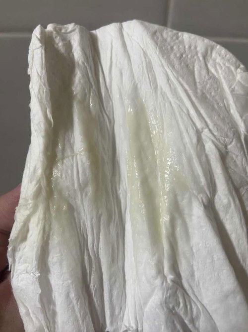 Keluar keputihan tiba2 normal ke?