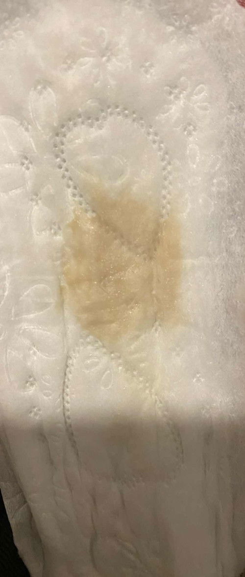 Apakah ini flek bunda2?