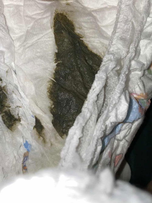 Pup bayi 7 bulan warna hijau ke abuan