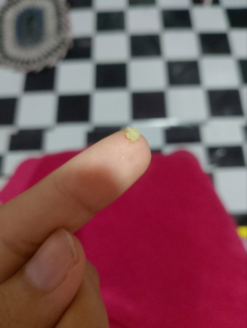 ตกขาวสีเขียวขาวเป็นก้อน