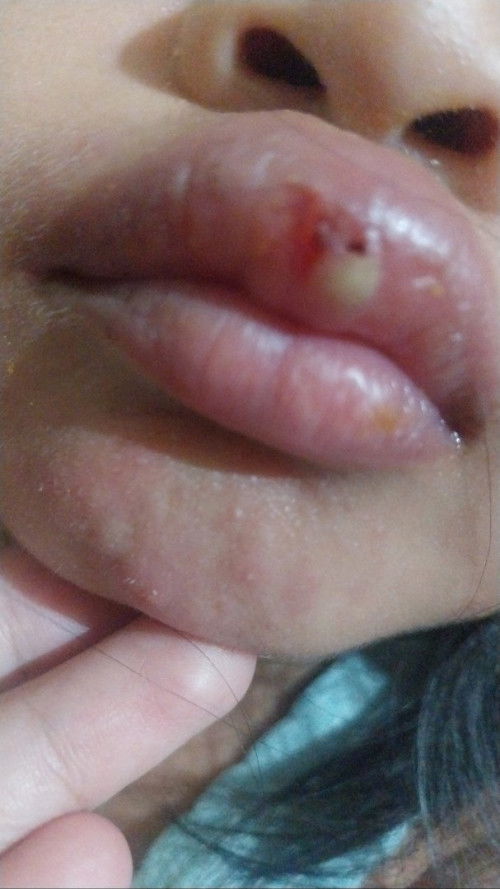 Bun ini knpa ya. Kya ada nana ny gitu.
Apa minum minum prolacta ya.